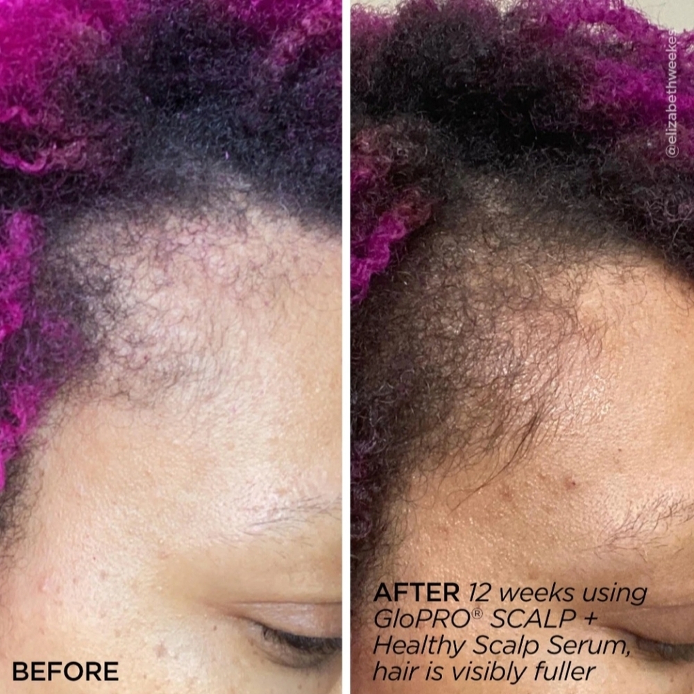 BeautyBio Scalp Therapy Set - Picture 10 of 11